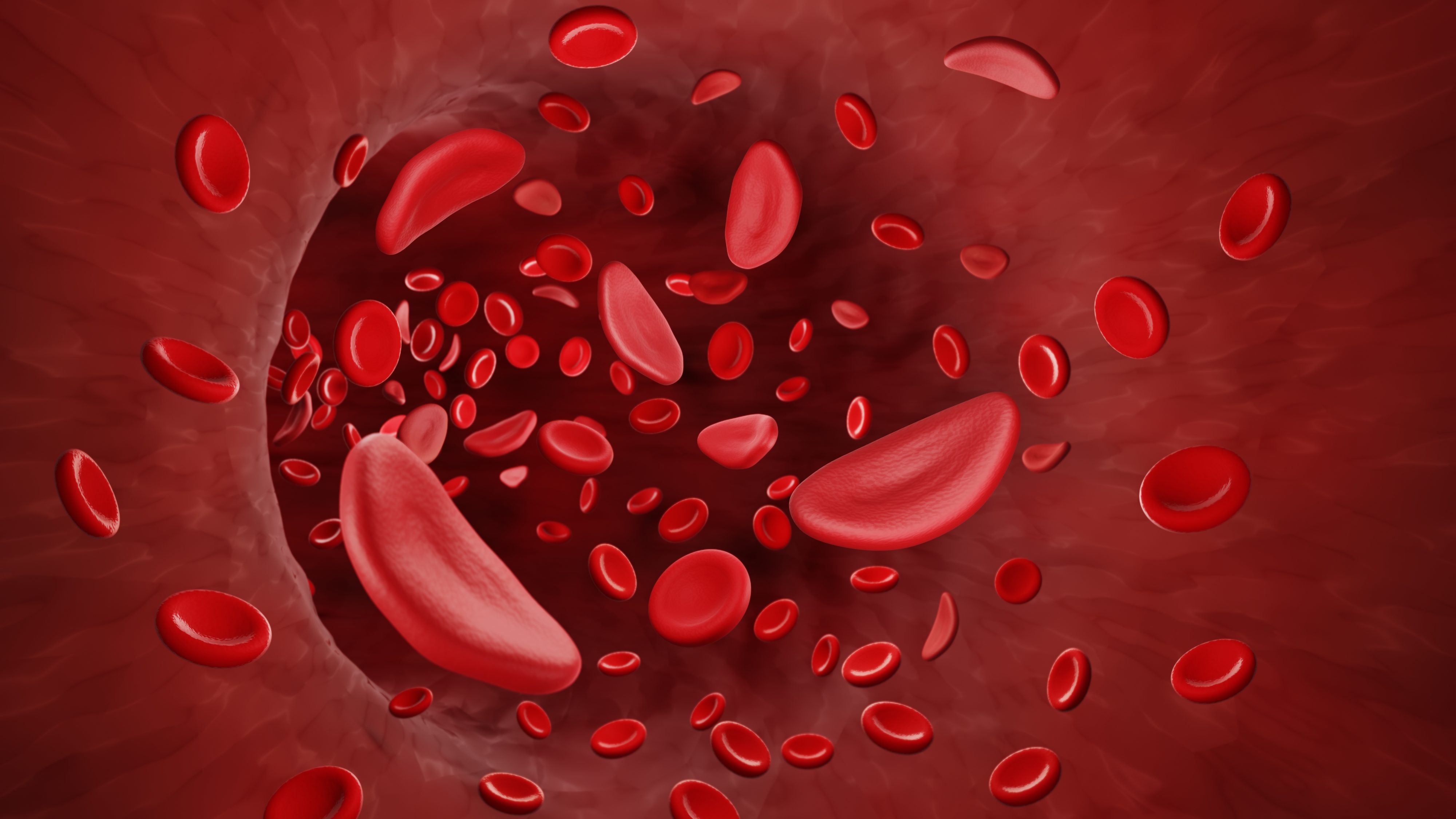 Sickle cell blood illustration